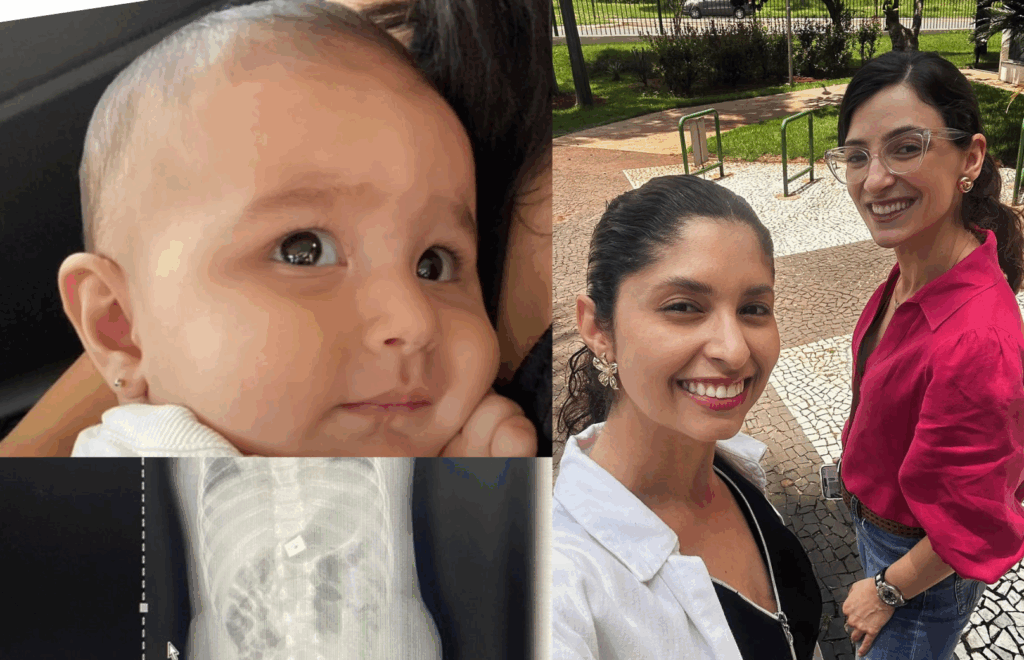 Maria Giovana e Esther Moraes Vaga Unicamp Bebê engoliu objeto metálico