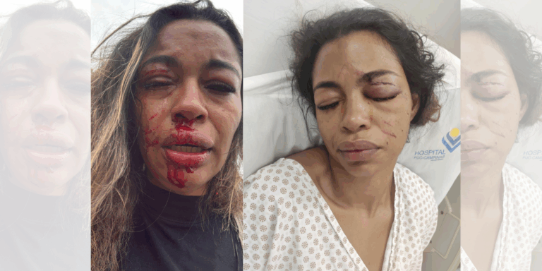 Grávida de 4 meses diz que foi agredida por cozinheira após reclamar de merenda escolar em Campinas